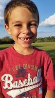 3rd Missing Tooth
